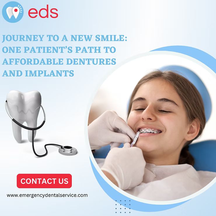 Full Denture Implants