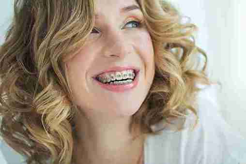 invisalign