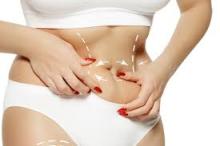 Tummy Tuck in Dubai