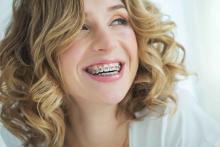 ! It shows a person with a bright smile and wearing traditional metal braces. 