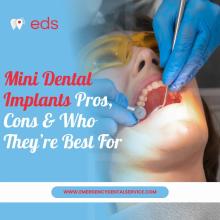 Dental Implants