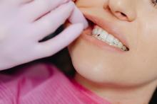 Best Dentist in Jaipur