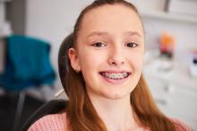 Braces in Edmonton