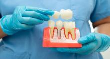 Transformative Dental Implants for Lasting Smiles