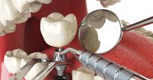 dentaldelhi