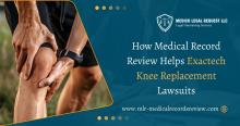 Exactech knee replacement lawsuit