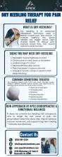 Dry Needling Madison