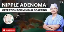 best breast cancer surgeon in pune