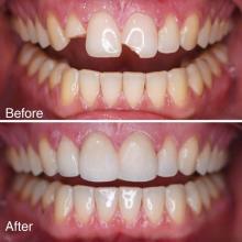 Transform Your Smile with Expert Care at Revive Dental Mississauga