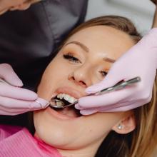 dental crowns