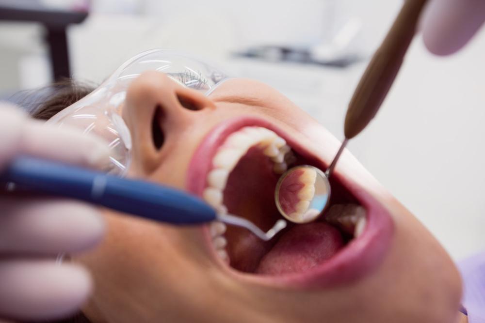 Dental Fillings Medicine Hat