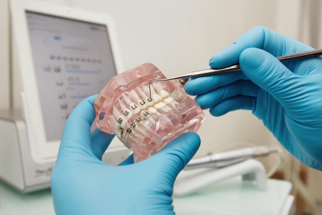 Anatomy of Fixed Braces: Know Every Part of Your Orthodontic Solution