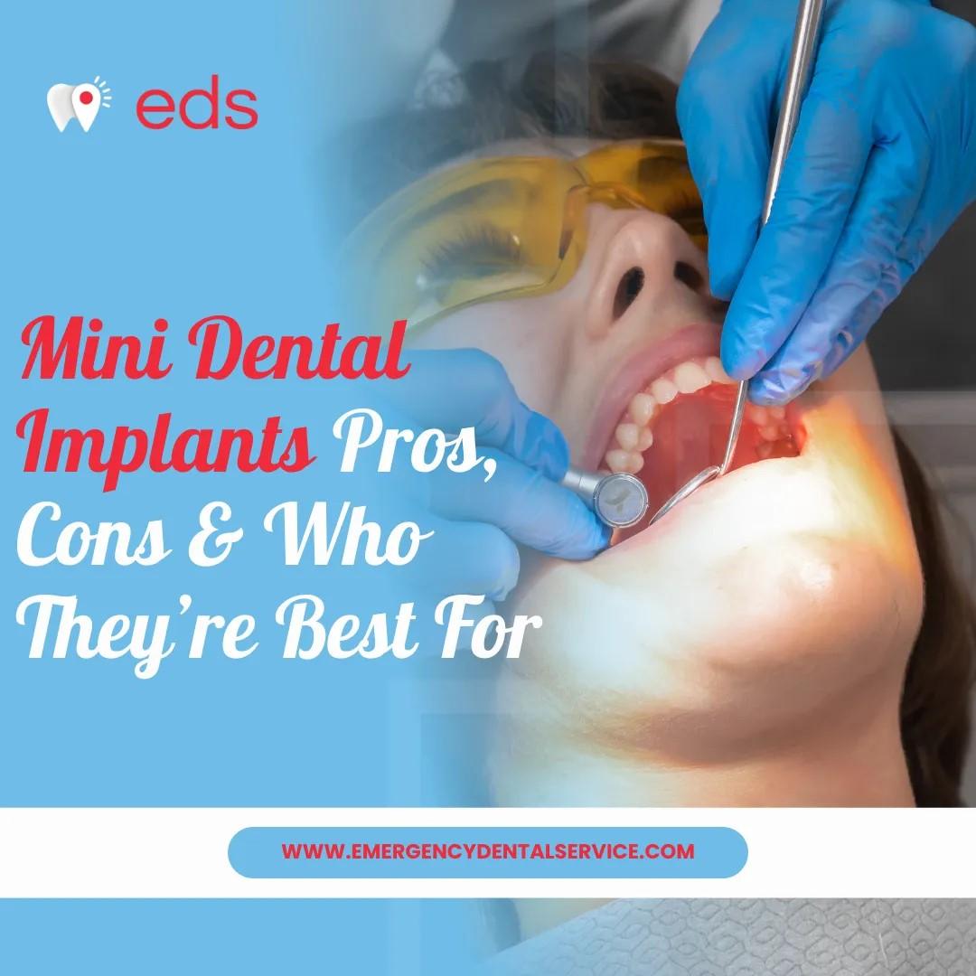 Dental Implants