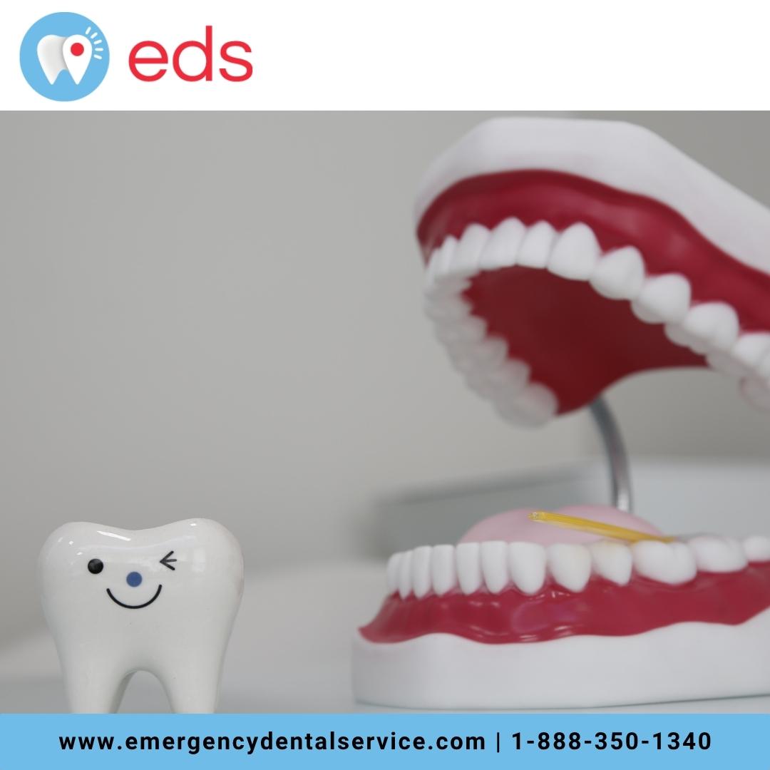 Overdenture Implants in Indianapolis, IN