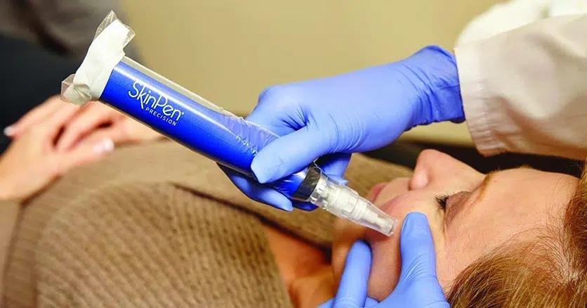 Microneedling