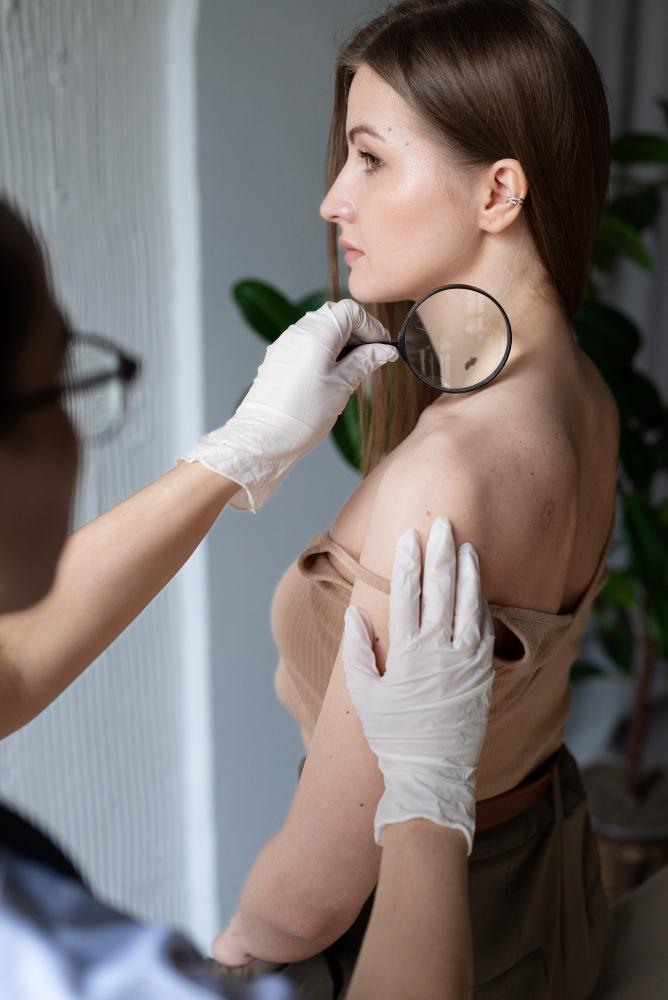 Molluscum Contagiosum Treatment Market