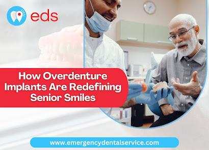 Overdenture Implants