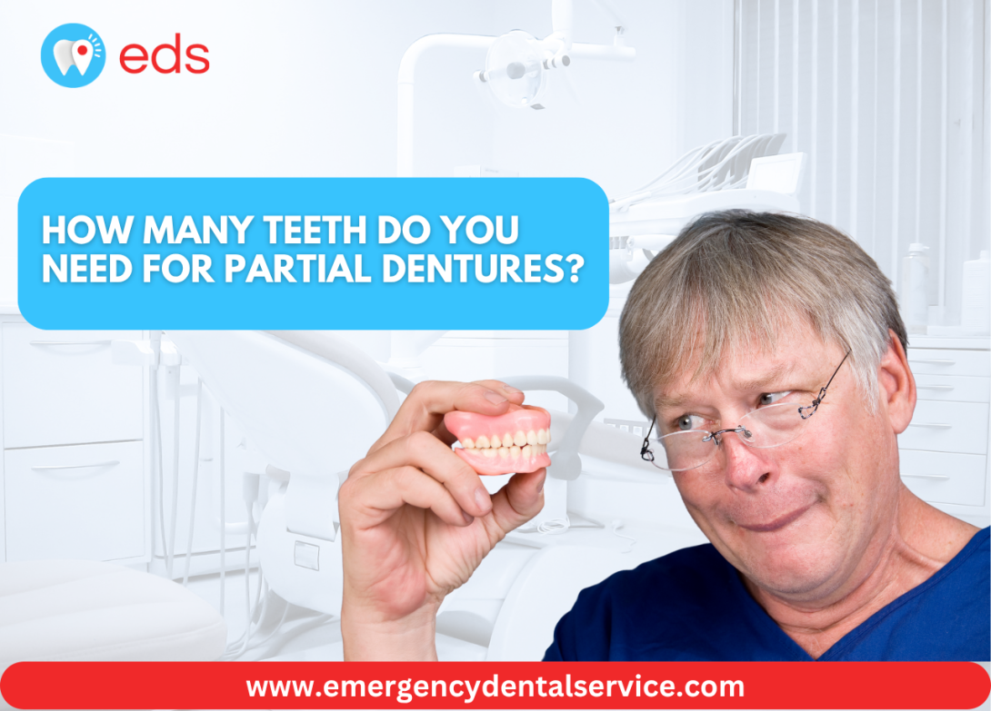 Dentures for Missing Teeth