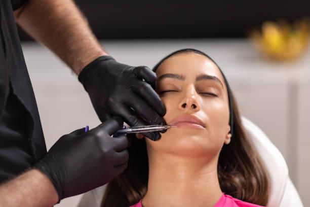 Lip Fillers injection in Dubai