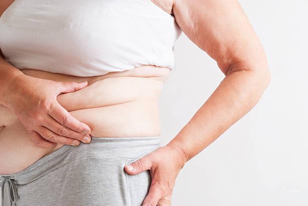Post-weight loss surgery in Dubai