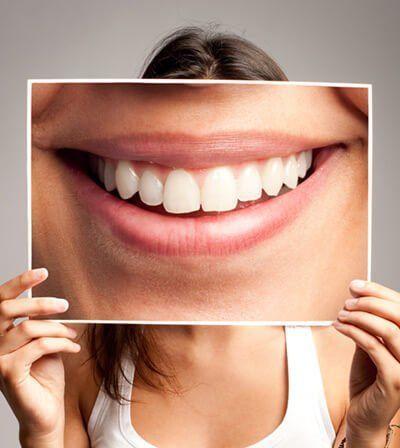 Dental implants in Mississauga Ontario for missing teeth restoration