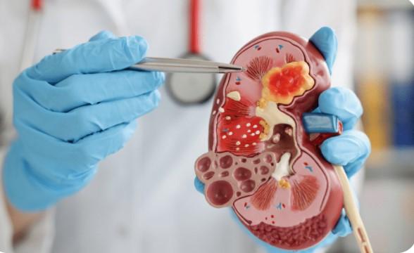Best Urologist In Bengaluru 