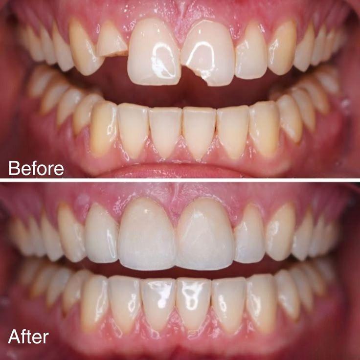 Transform Your Smile with Expert Care at Revive Dental Mississauga